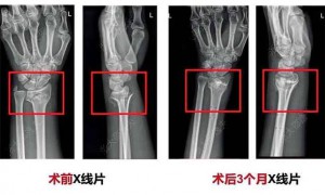 世界性难题，攻克了？